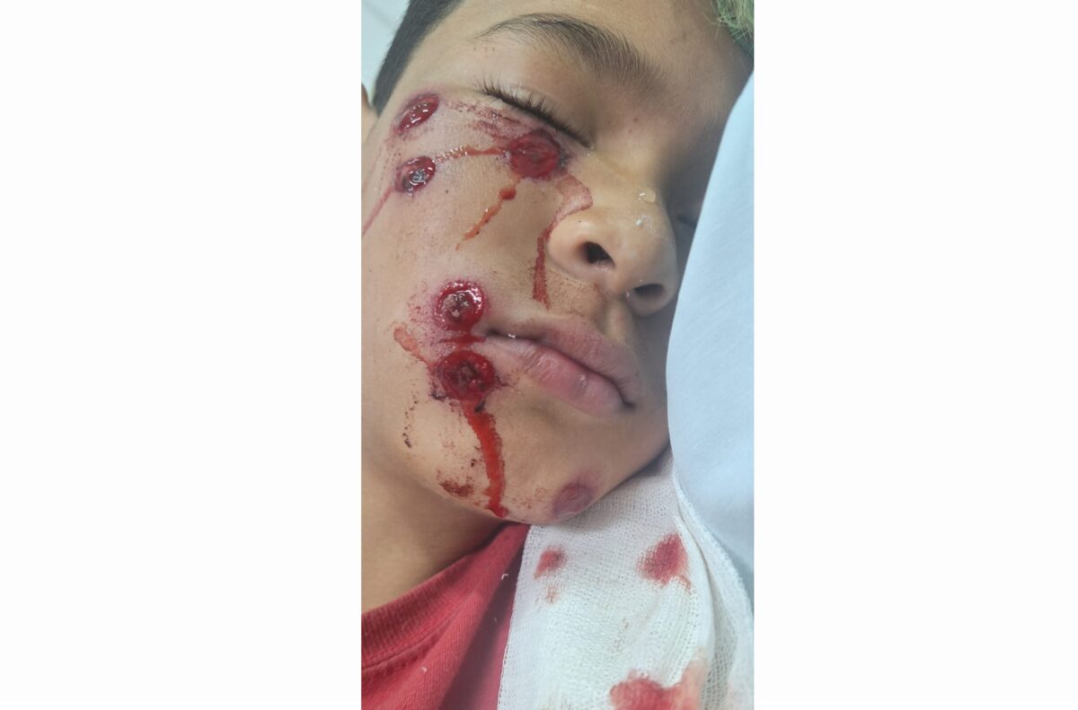 Niño herido con balas de goma durante operativo policial en comedor de Quilmes a10925d4-91dd-48e4-af1d-156d8f4e9a5dK