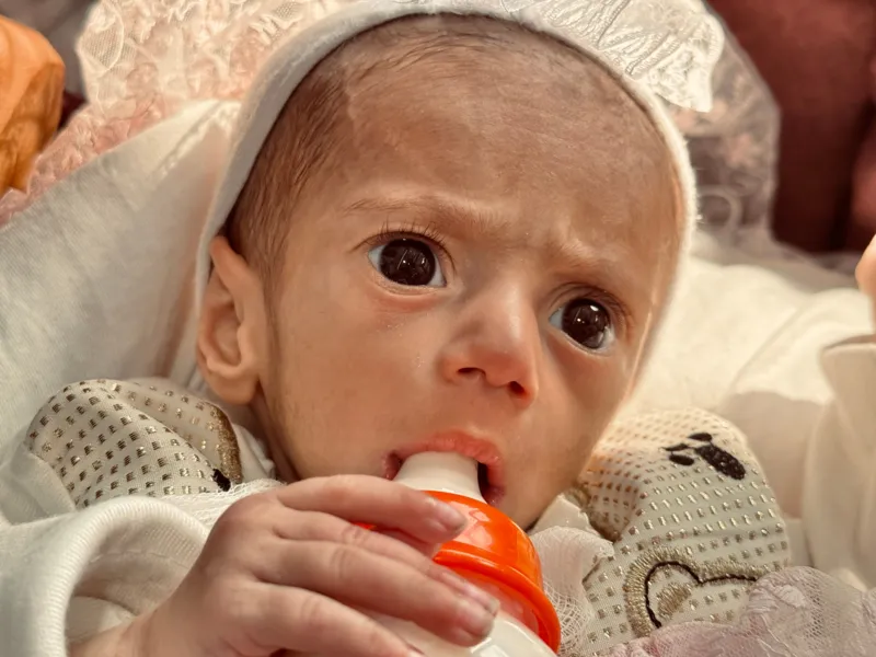 Pesa 3 kilos y sobrevivió a la guerra: Siwar, la beba palestina evacuada de Gaza que conmovió al mundo 774995e0-4712-11f0-9471-e380f647874e.jpg