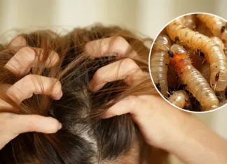 Corrientes: una nena llegó al hospital por un fuerte dolor de ojo y los médicos descubrieron una infección extrema en el cuero cabelludo