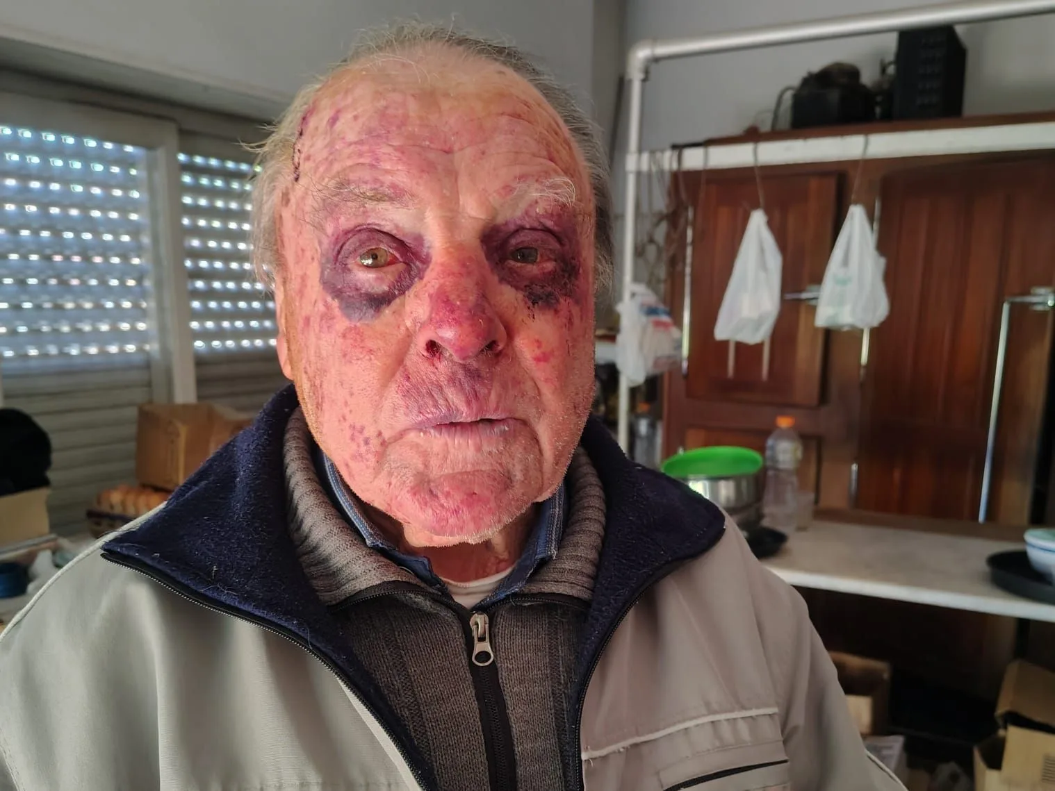 Miramar: el duro testimonio de Alicia Garros tras el violento ataque a su padre de 90 años y a su hermano garro