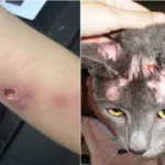 Alerta epidemiológica: detectan un hongo que se transmite de gatos a humanos gato9678